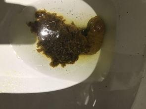 吃瓜大便不成型,揭秘“吃瓜大便不成型”背后的健康秘密